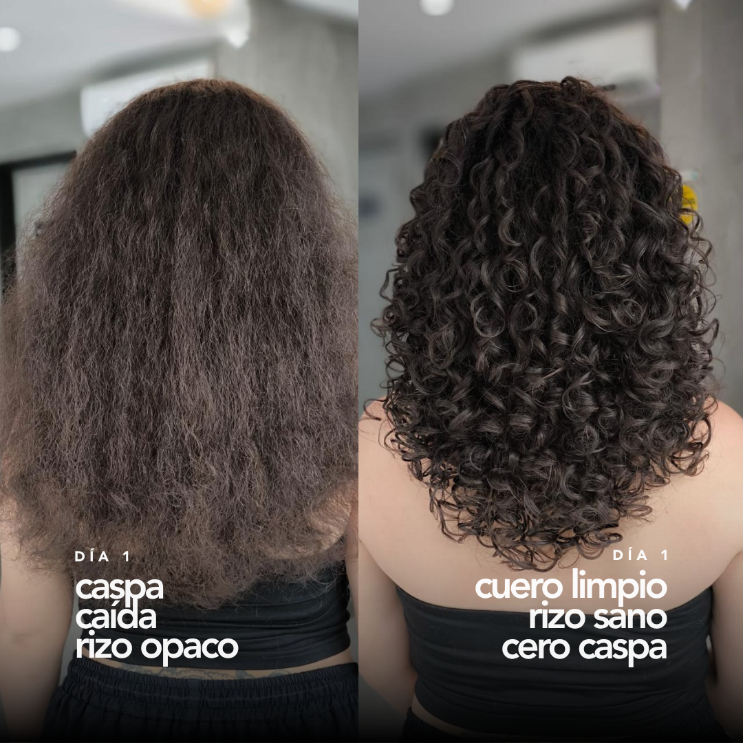 Shampoo